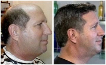 Before and After Man's Hair Treatment — West Chester, OH — Gilda's Hair Studio