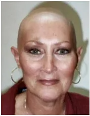 Before Woman's Hair Treatment — West Chester, OH — Gilda's Hair Studio