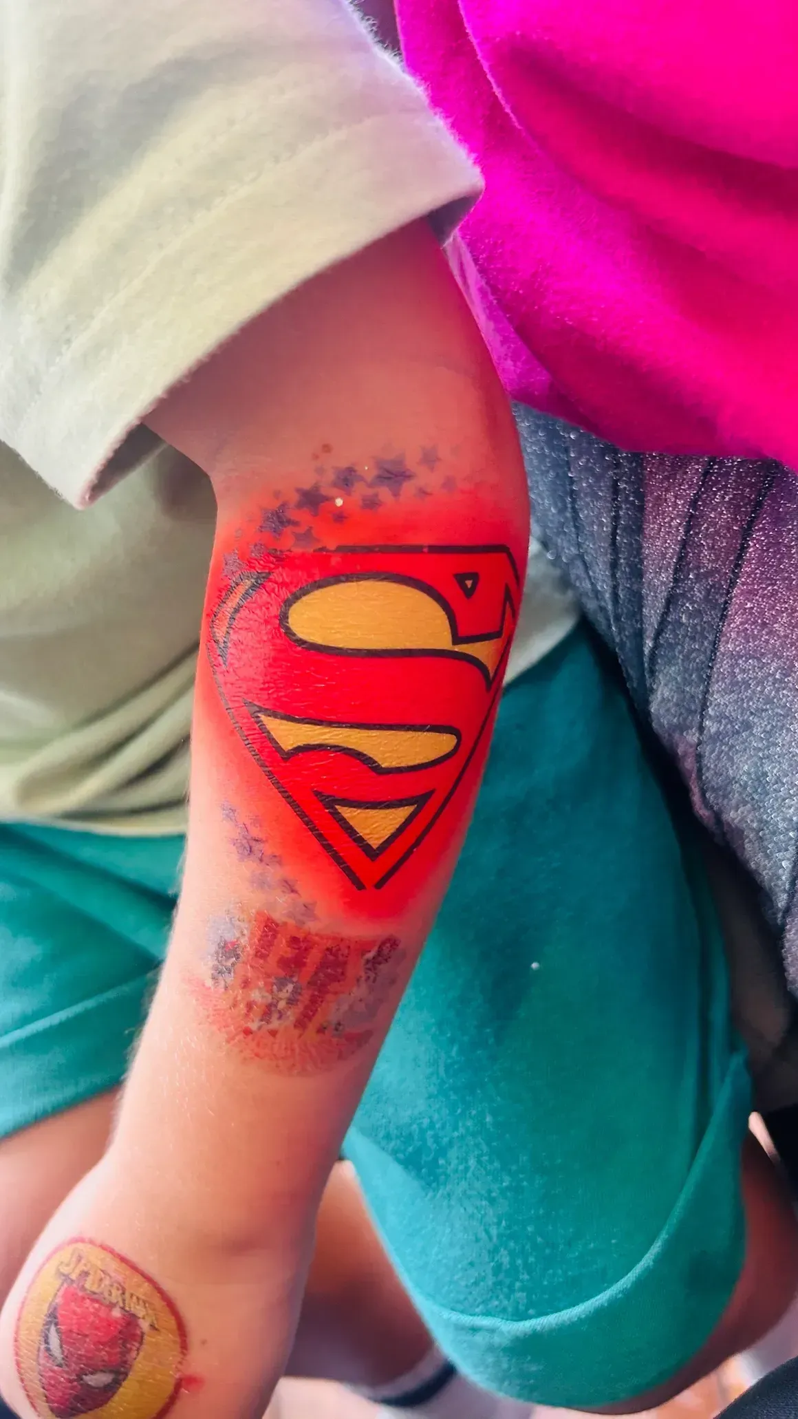 Child's arm with a Superman logo airbrushed on the elbow, red and yellow.