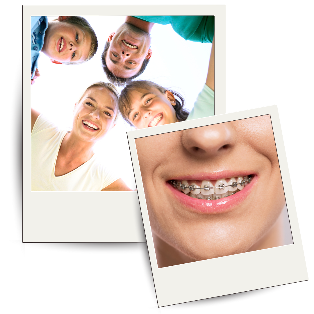 Metal Braces | Eugene, OR | Dr. Bennion Orthodontics