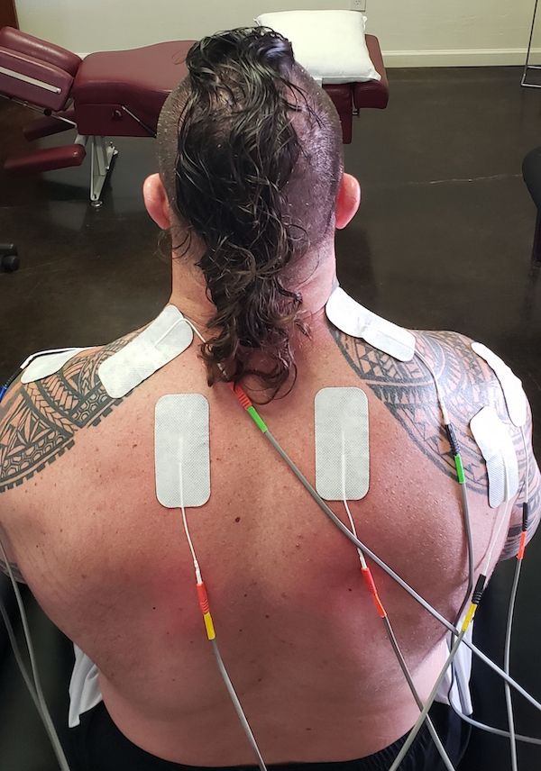 Person's back with electrodes attached. Wires connect the electrodes. Dark hair, tattoo on left arm, white patches on skin.