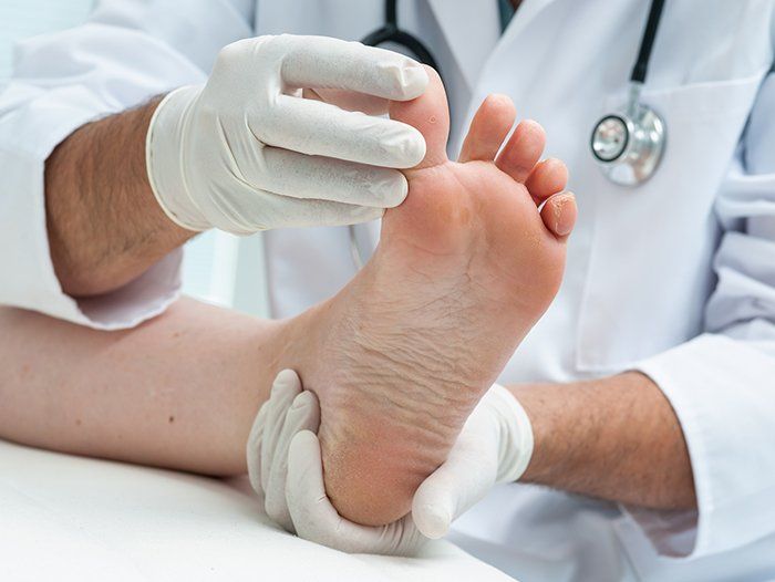 Athlete's Foot Checkup — Fenton, MI — Associated Foot Clinic Of Fenton PC