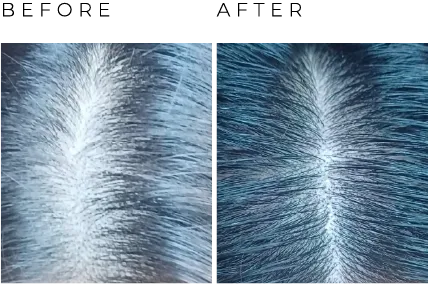 before and after