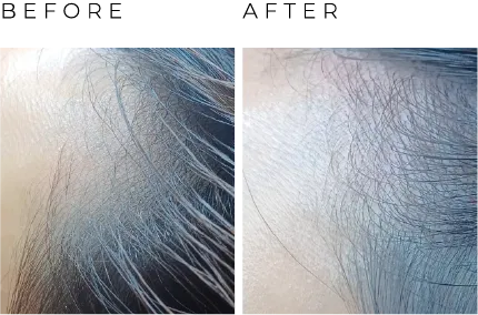before and after