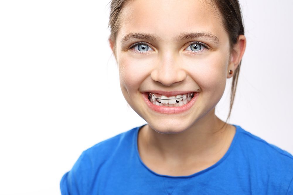Young Person Smiling With Teeth Retainer, Blue Shirt, Bright Background — Tamworth Orthocare In Muswellbrook, NSW