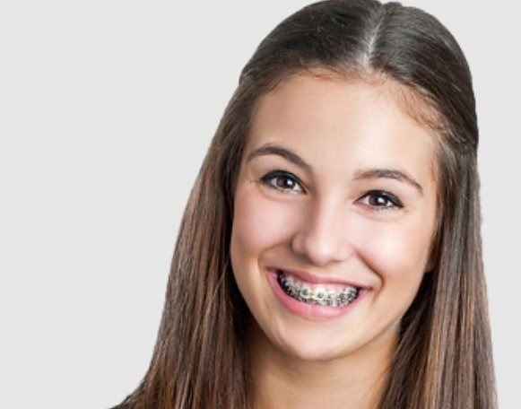 Smiling Person With Braces — Tamworth Orthocare In Tamworth, NSW