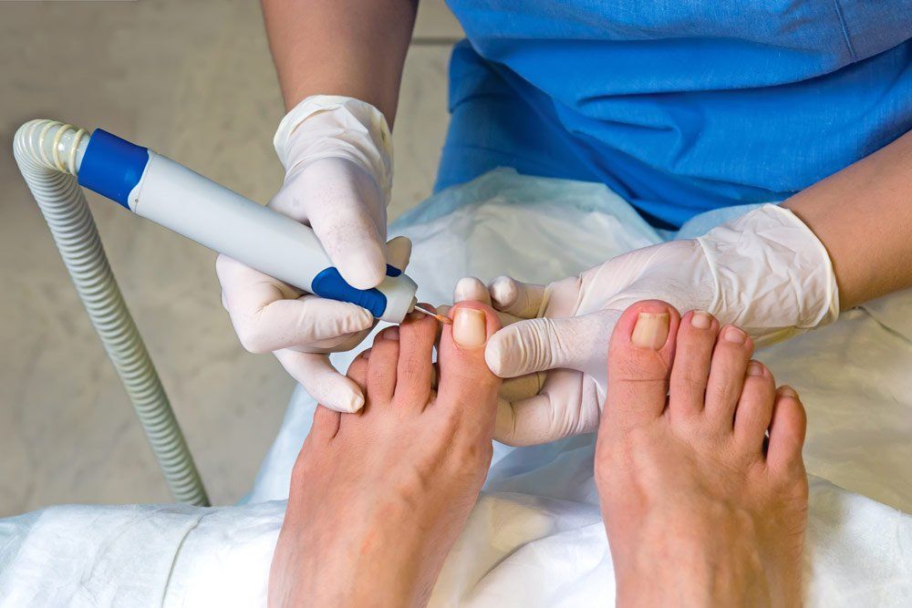 Ingrown Toenail Pain Relief - Your Foot And Ankle Clinic