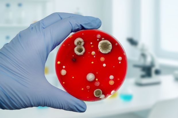 Gloved hand holding a petri dish with bacterial colonies in a lab setting. The agar is red, colonies white/gray.