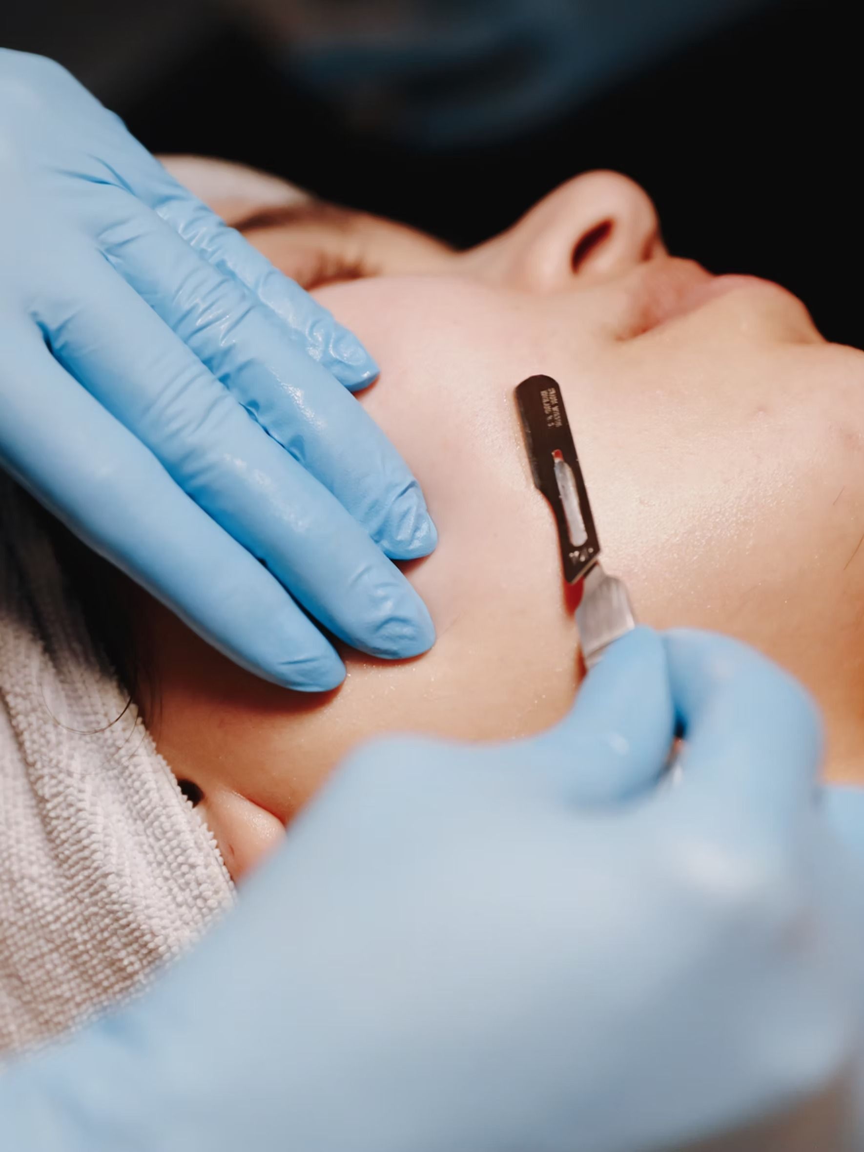 Gloved hands applying a cosmetic treatment to a person’s cheek with a facial brush