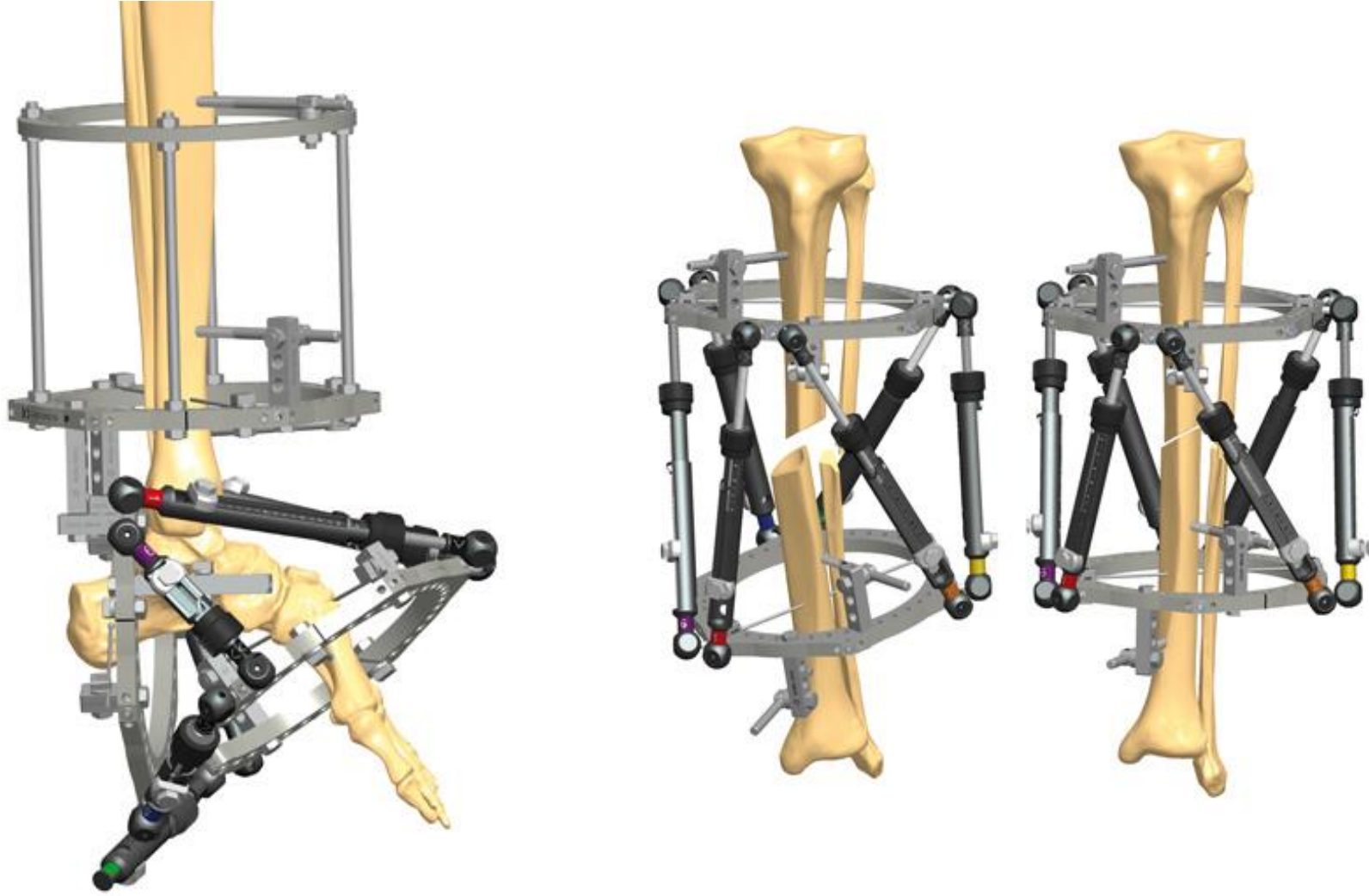 A 3d model of a leg and a 3d model of a leg in a cage.