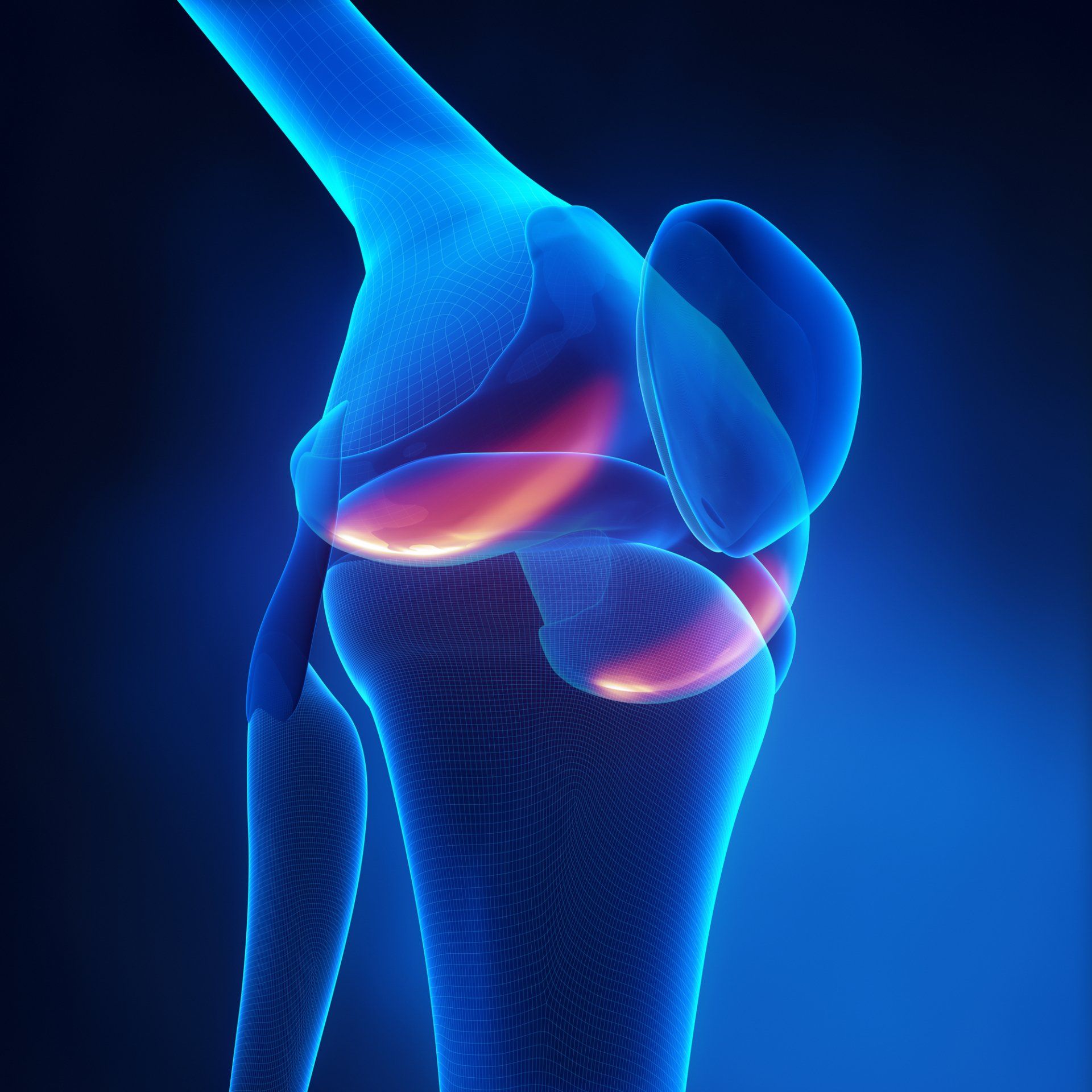 Knee Pain Doctor Springfield NJ