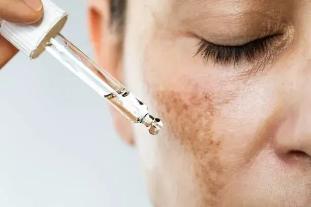 Dropper Applying Serum to a Face — A9 Skin and Hair Clinic In Westmead, NSW