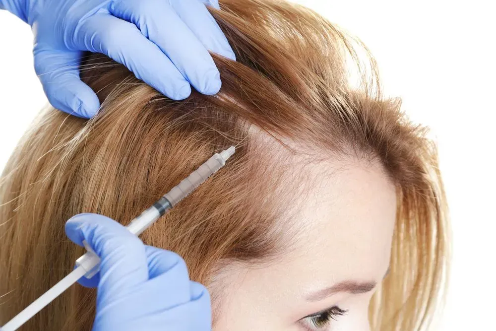 Gloved Hands Injecting a Woman’s Scalp With a Syringe — A9 Skin and Hair Clinic In Westmead, NSW