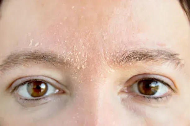 Close-up of a Person's Eyes and Upper Face — A9 Skin and Hair Clinic In Westmead, NSW