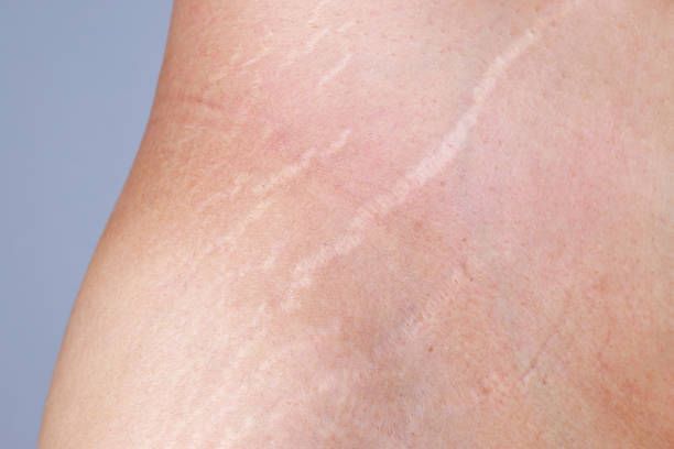 Close-up of Smooth, Pale Skin — A9 Skin and Hair Clinic In Westmead, NSW