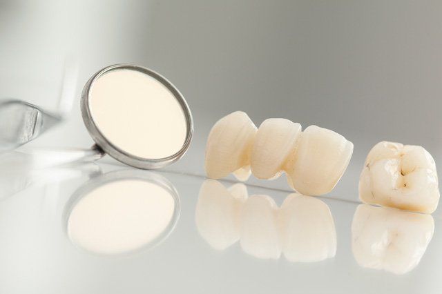 ceramic dental bridge and mirror on desk