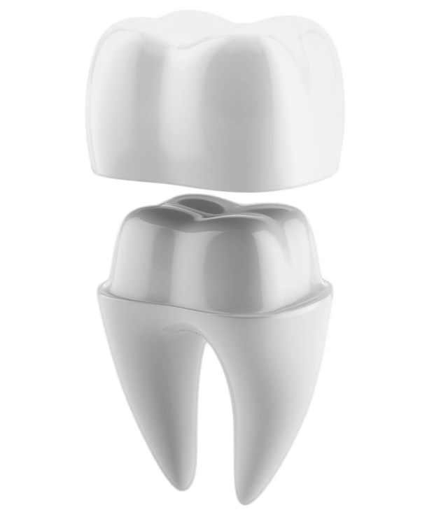 illustrated diagram of tooth getting a crown cap
