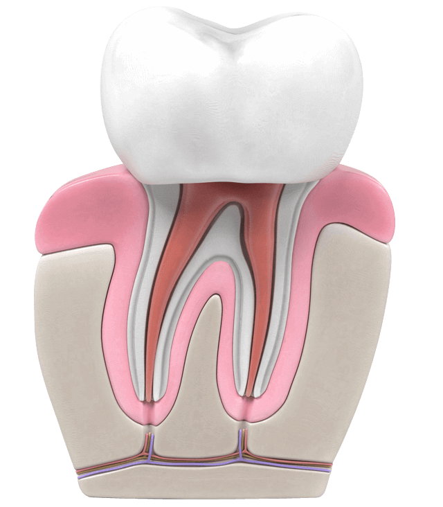 illustration of root canal