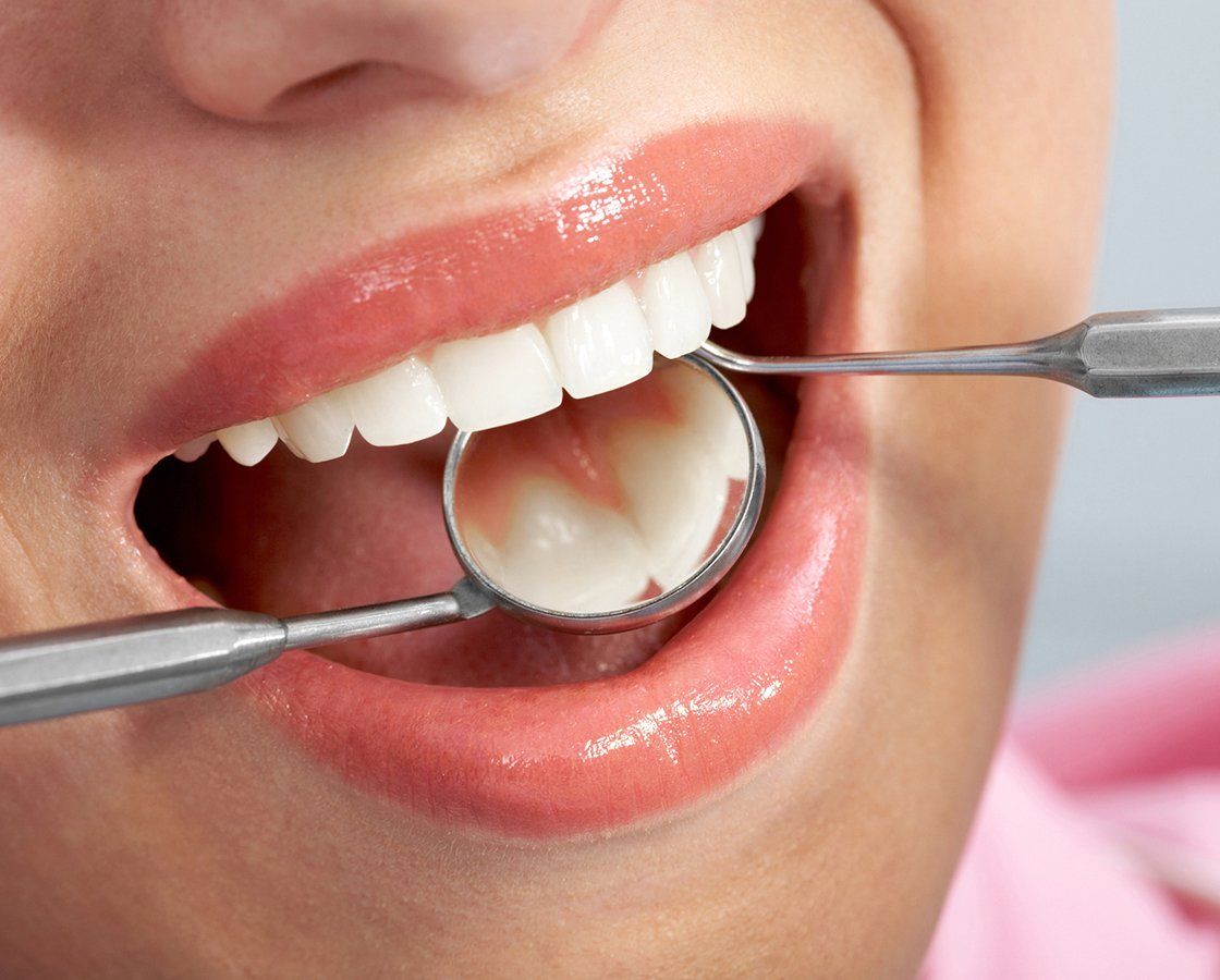 Checking Patient Teeth — Waynesboro, GA — Burke Co. Dental