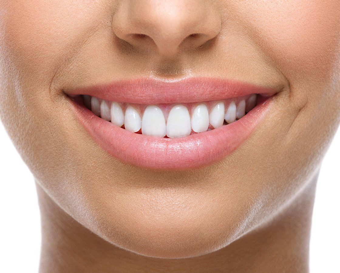Perfect White Teeth — Waynesboro, GA — Burke Co. Dental