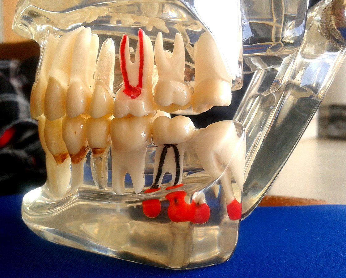 Teeth Educational Model — Waynesboro, GA — Burke Co. Dental
