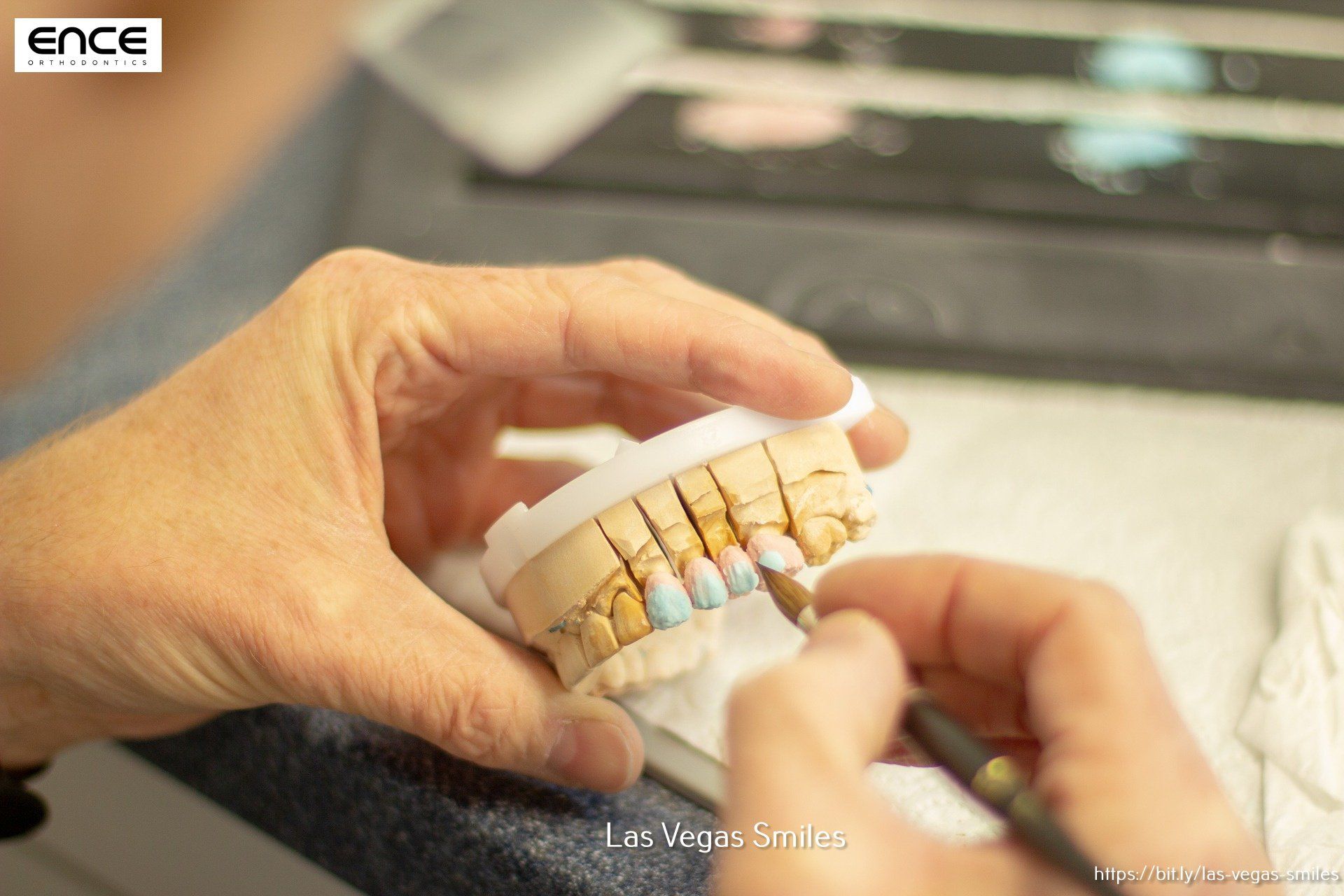 A person is holding a model of teeth in their hands.