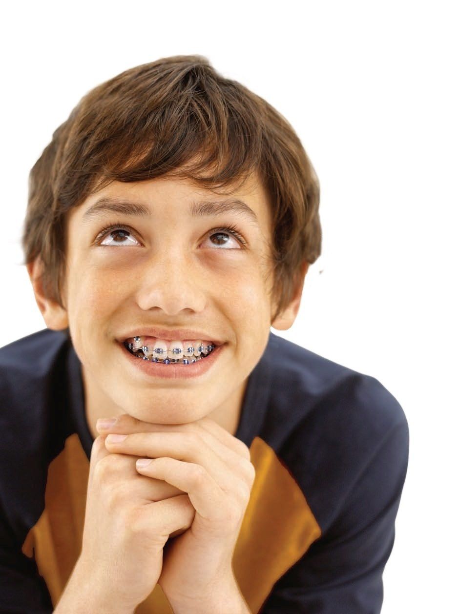 A young boy with braces on his teeth is smiling and looking up