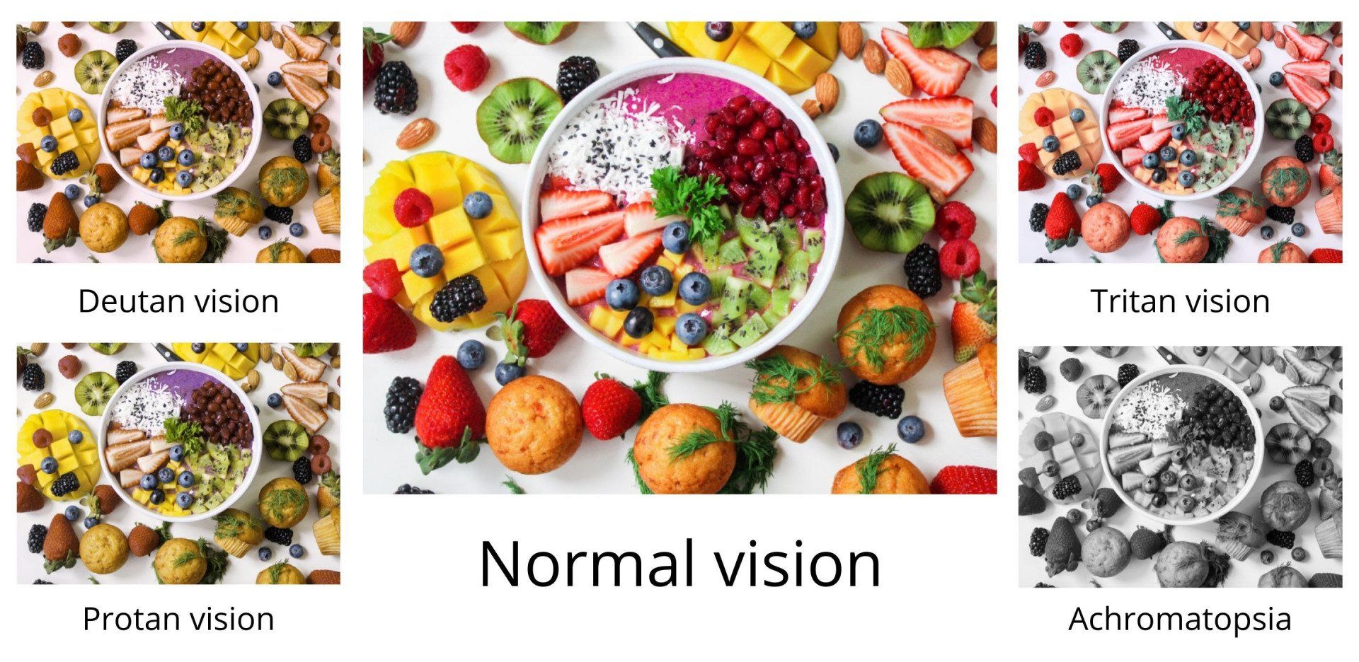 Various types of color blindness deficiencies