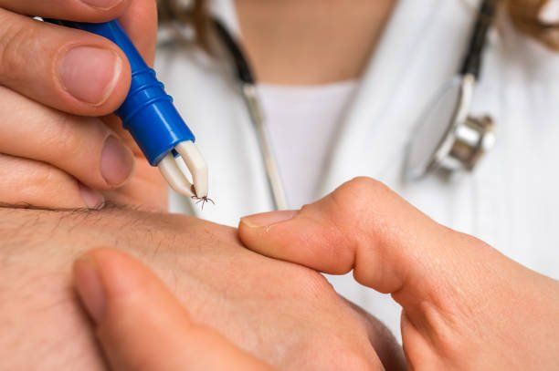 Lyme Laser Theraphy — Hampden, ME — Baker Family Chiropractic