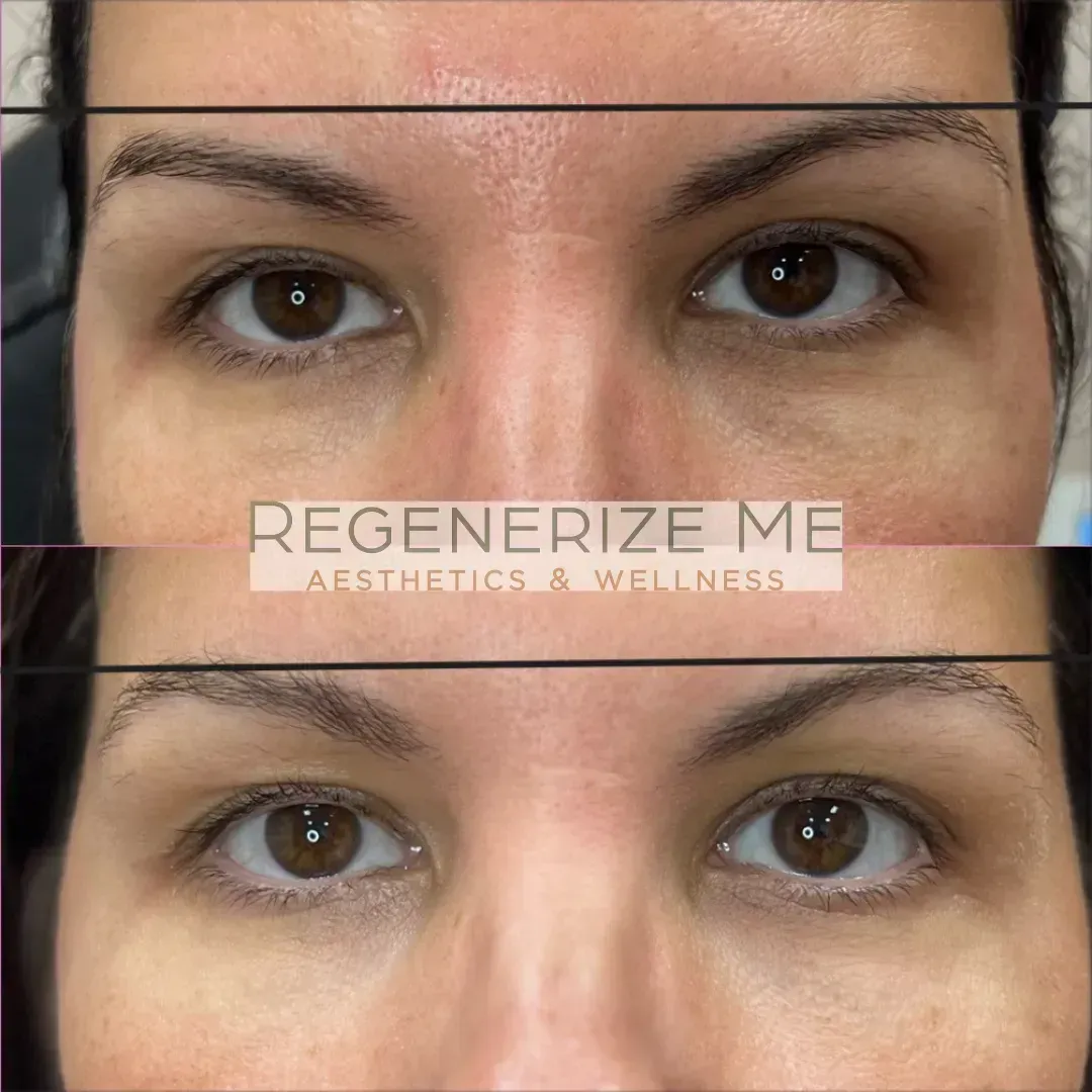 A before and after photo of a woman 's eyes.