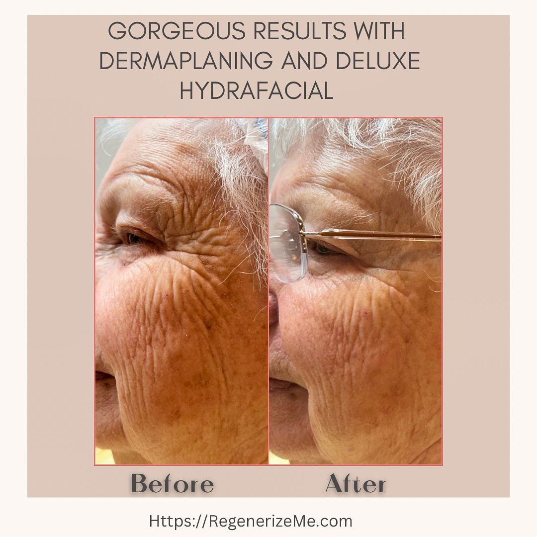 A before and after photo of a woman 's neck and neckline