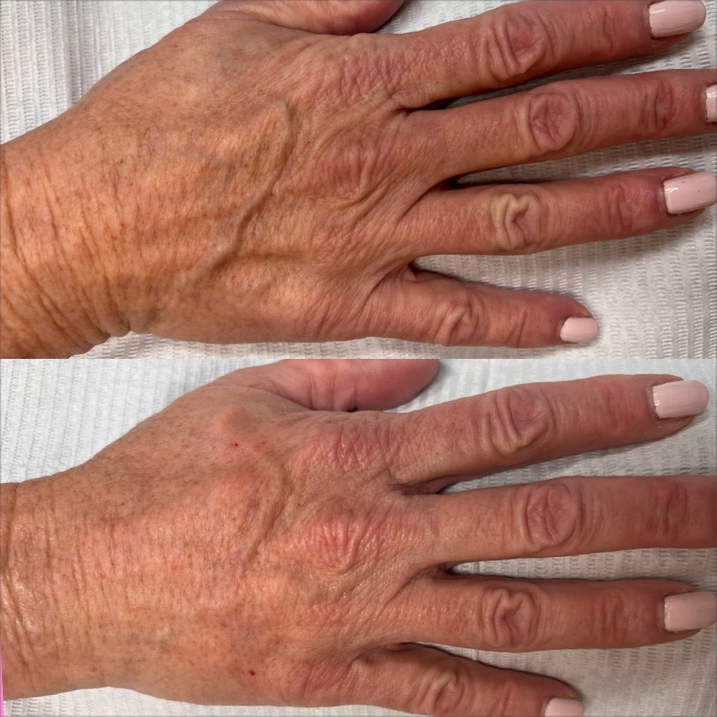 A before and after photo of a woman 's face says regenerate me