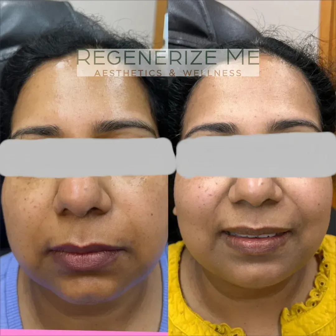 A before and after photo of a woman 's face says regenerate me