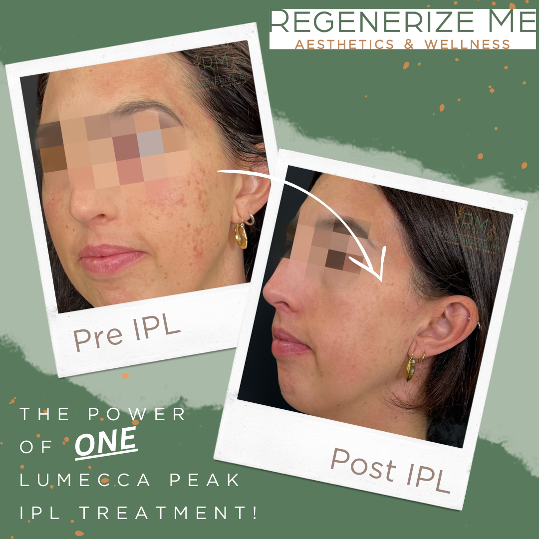 A before and after photo of a woman 's face says regenerate me