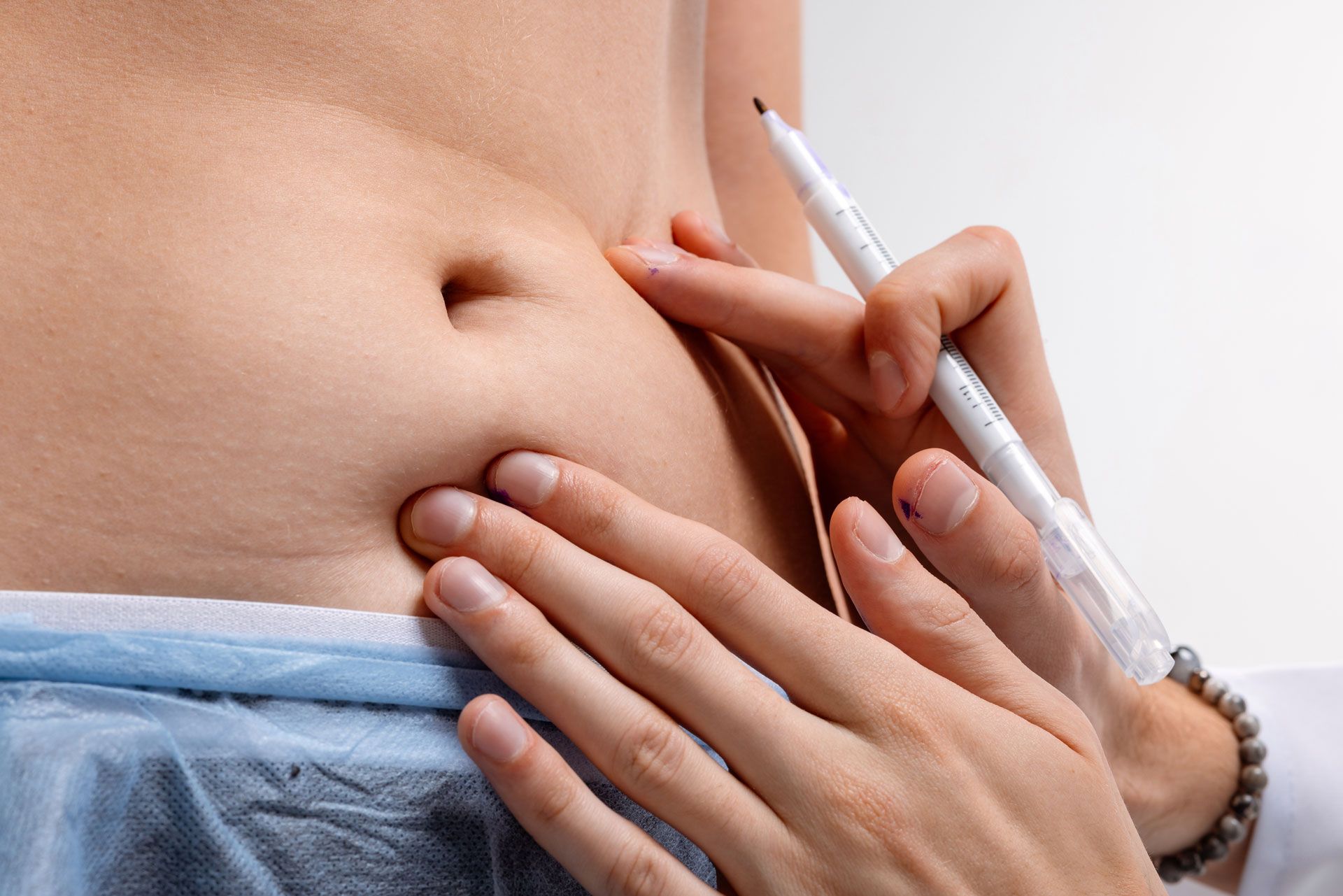 A healthcare professional marks a patient’s abdomen with a pen during a clinical examination.