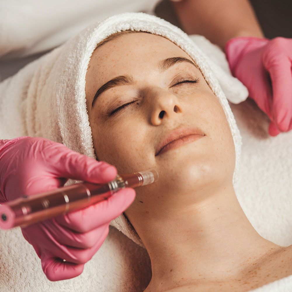 Woman Underoing Microneedling