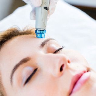 Hydrafacial Session on Woman's Face