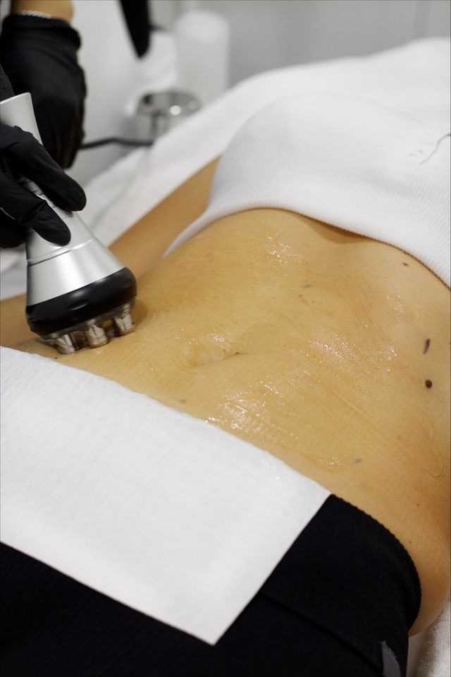 Radio Frequency Skin Tightening 101: Everything You Need To Know