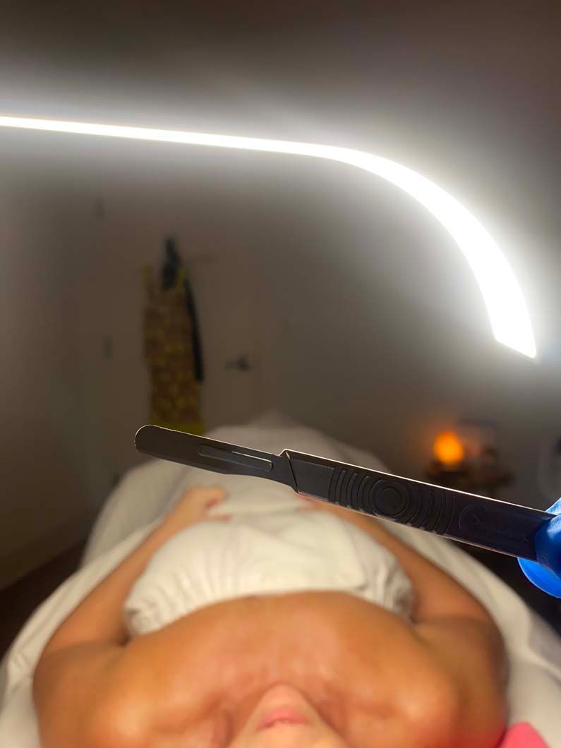 Person lying on a massage table, overhead light, tool held over chest.