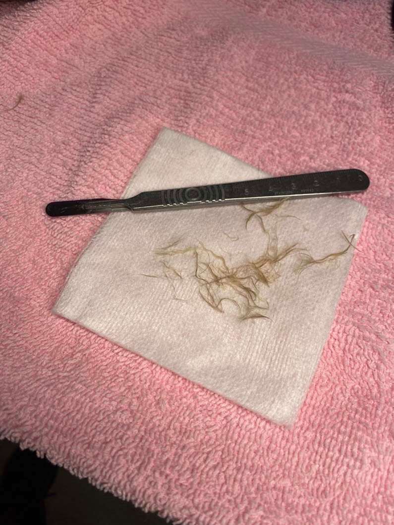 Brown hairs on a white cloth with a dark metal tool, resting on a pink towel.