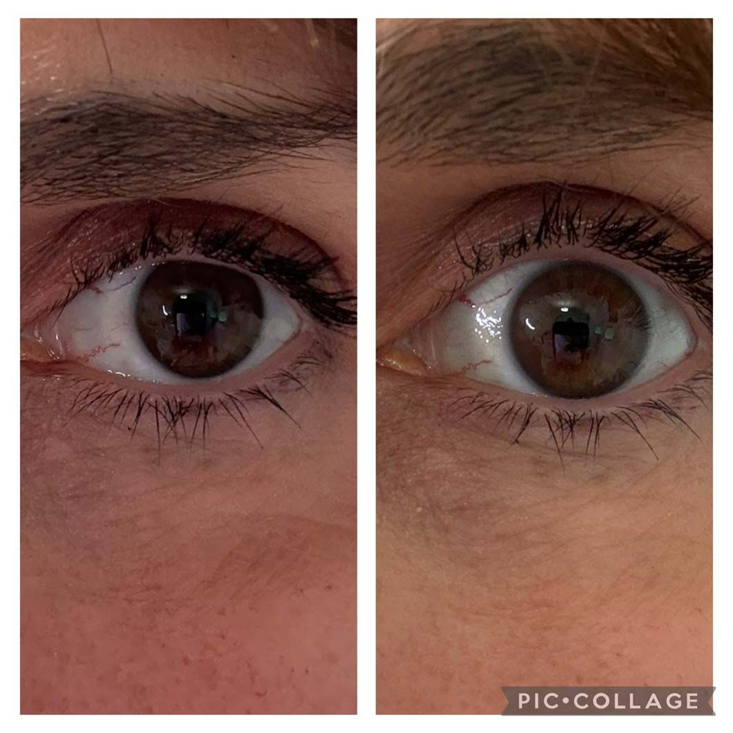 Two eyes with brown irises, one with slightly darker skin, comparing eyelash appearance.
