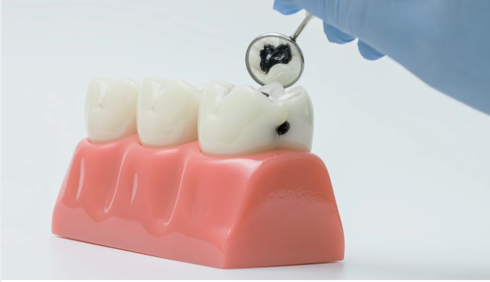 Healthy human smile with clean white teeth and toothbrush closeup