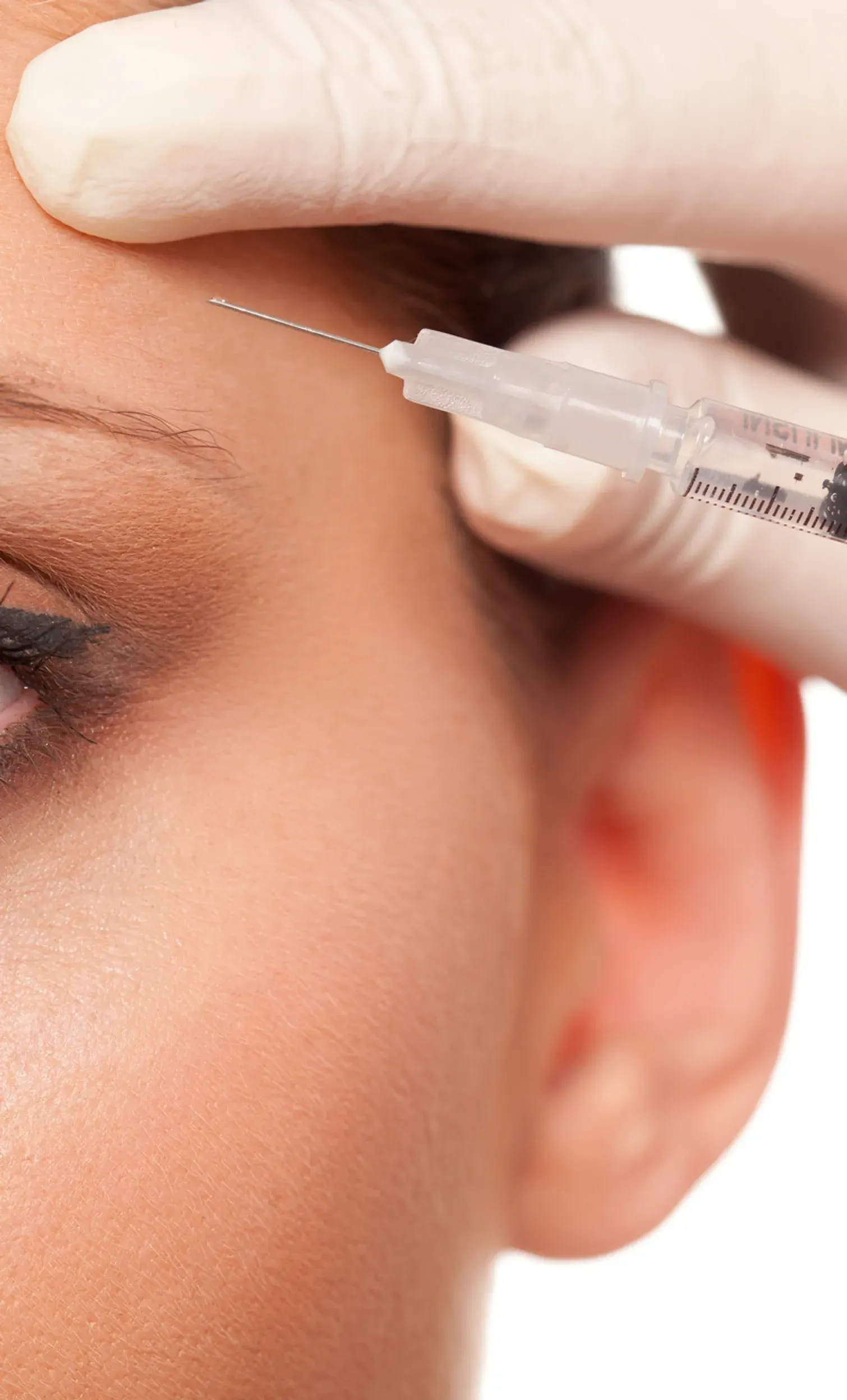 A woman is getting a botox injection in her forehead.