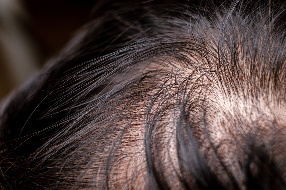 It is a close up of a person 's hair.