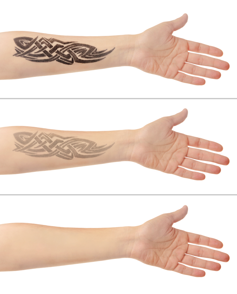 Three pictures of a person 's arm with a tattoo on it