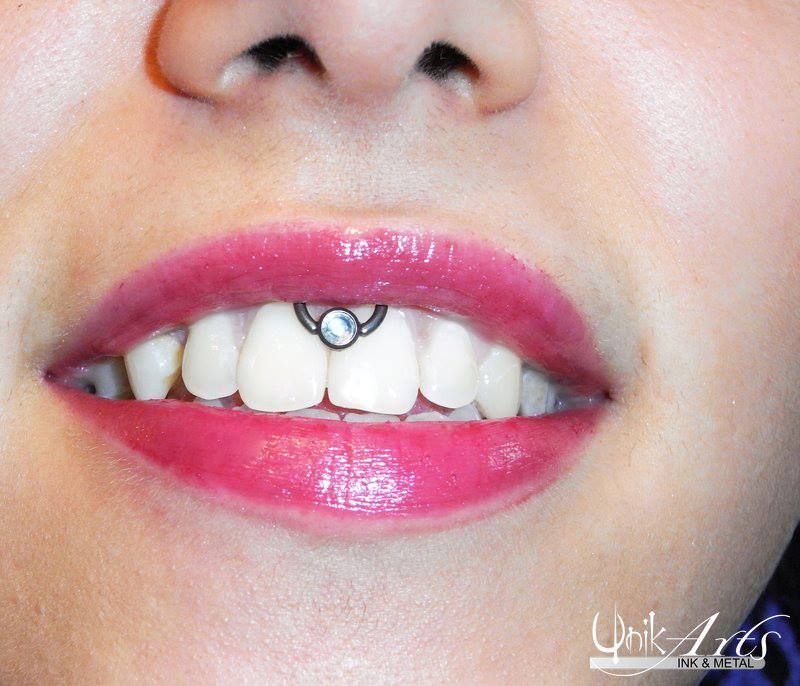 Oberlippenbändchen Frankfurt