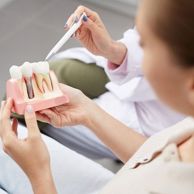 Dentist Explaining Dental Implants — Hickory, NC — McDonald Family Dentistry