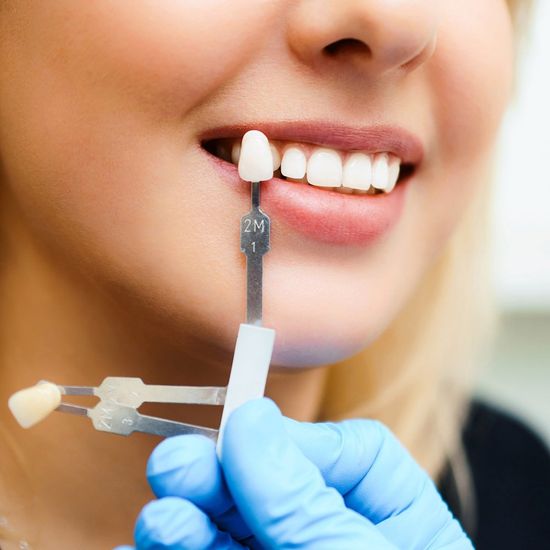 Preparing for Dental Implants — Hickory, NC — McDonald Family Dentistry