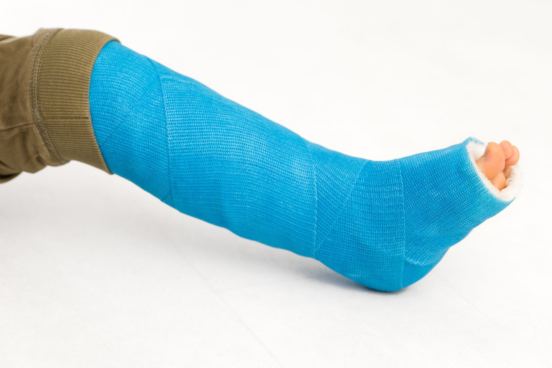 A person with a blue cast on their leg.