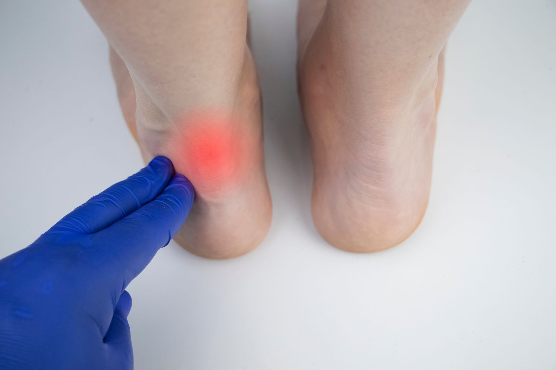 A person is holding their ankle in pain.